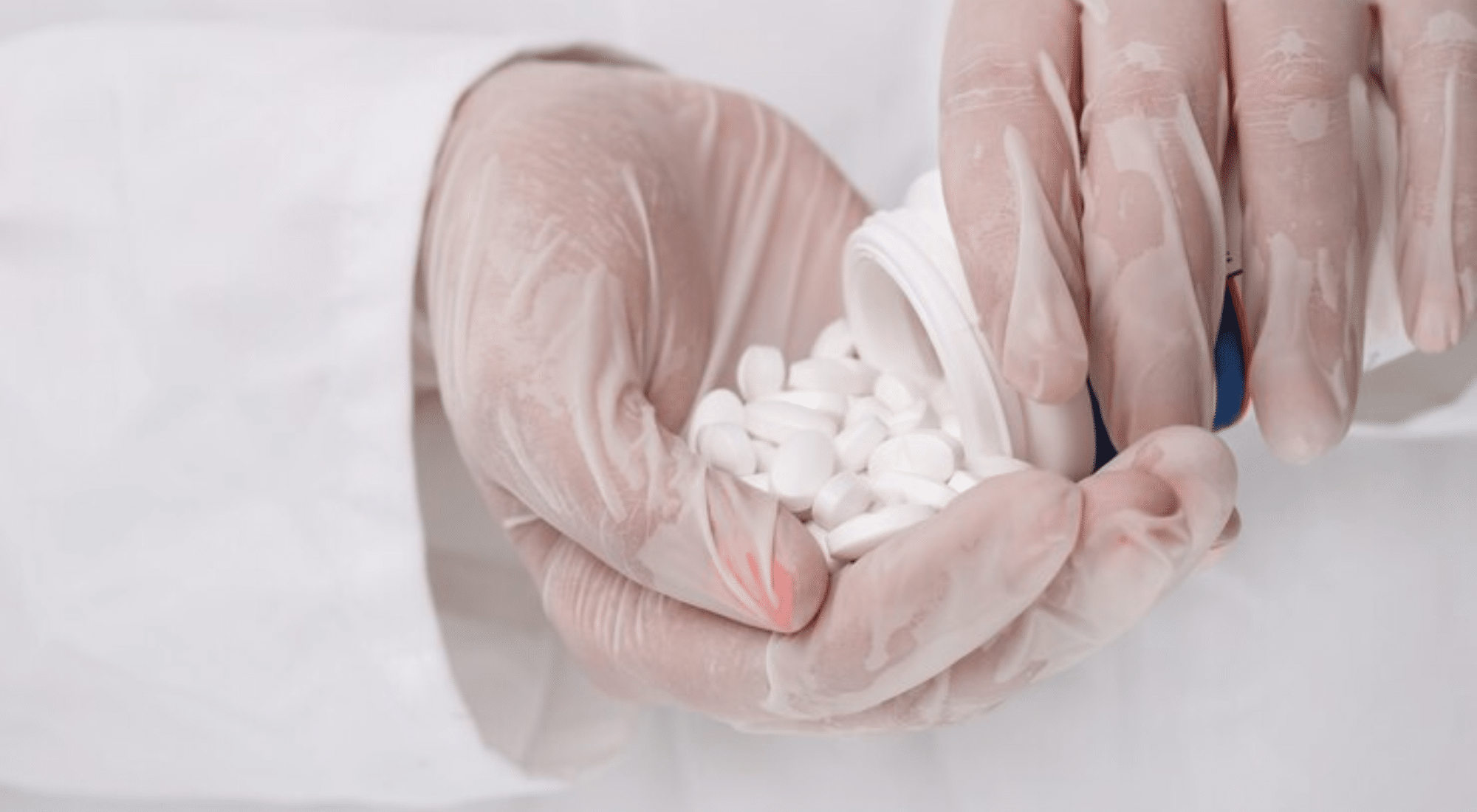 Dupuytrens kontraktur, palmar fibromatose (REV 063) – Grans Kompendium i  Revmatologi, image size:2000x1100