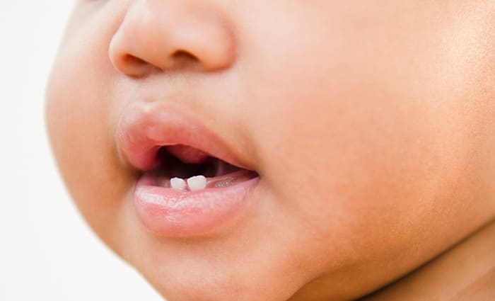 Will Teething Cause a Fever?