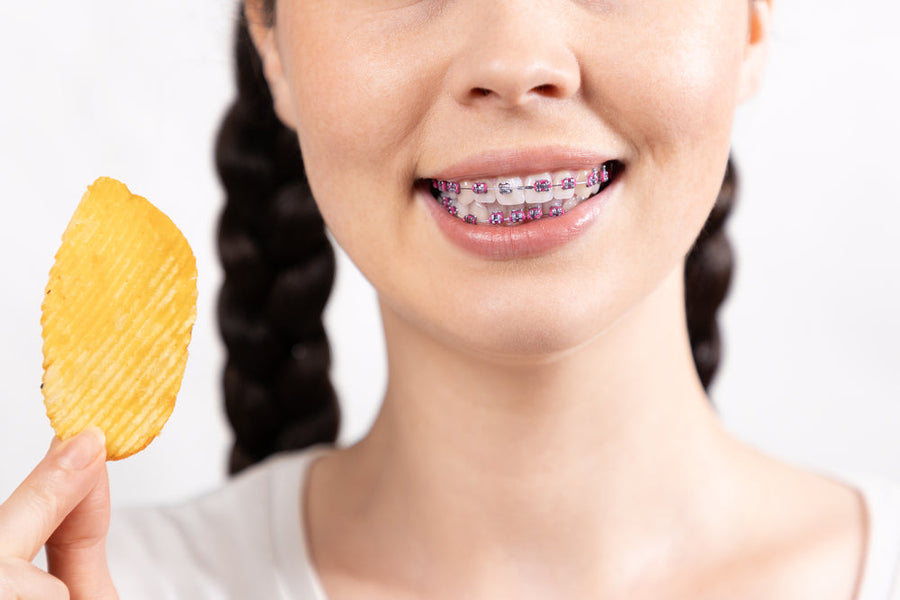 Can You Eat Chips with Braces? Tips & Safe Options